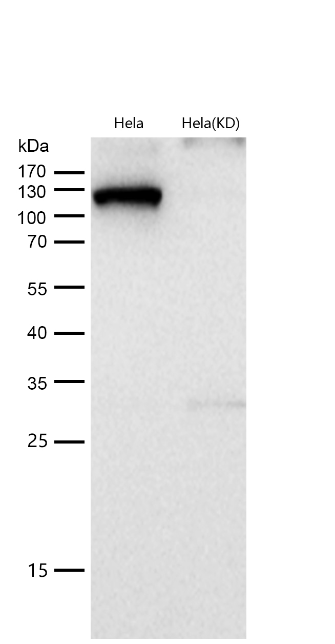 HAUSP / USP7 Rabbit mAb