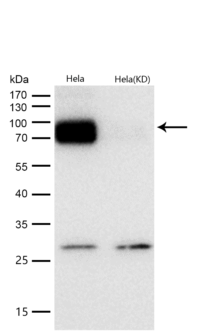 FOXO1 Rabbit mAb