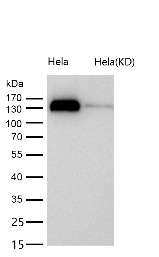 p150 CAF1 Rabbit mAb