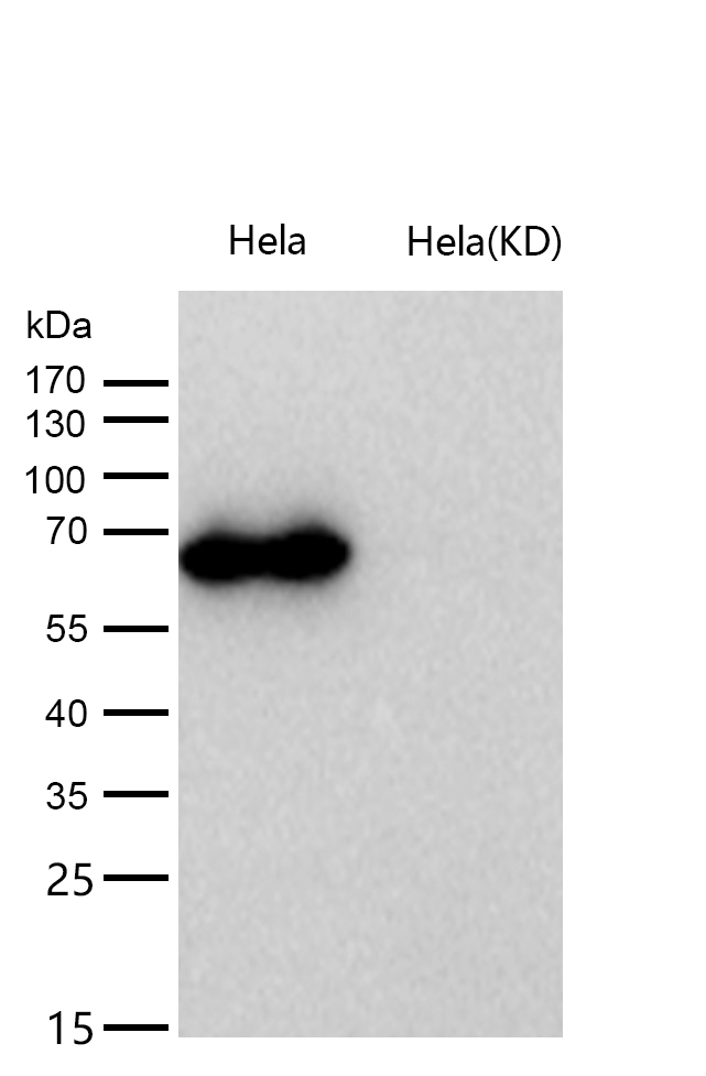 Methionine Aminopeptidase 2 Rabbit mAb