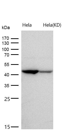 KAT1 / HAT1 Rabbit mAb