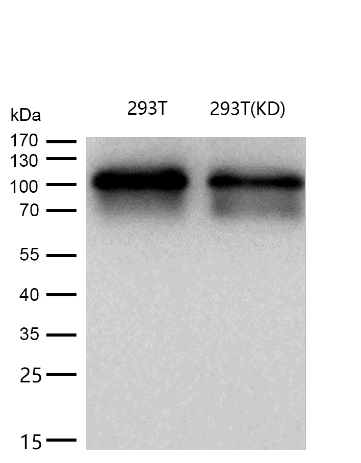 HSF1 Rabbit mAb