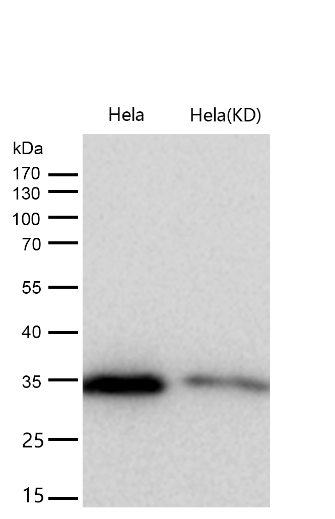 GNB2 Rabbit mAb