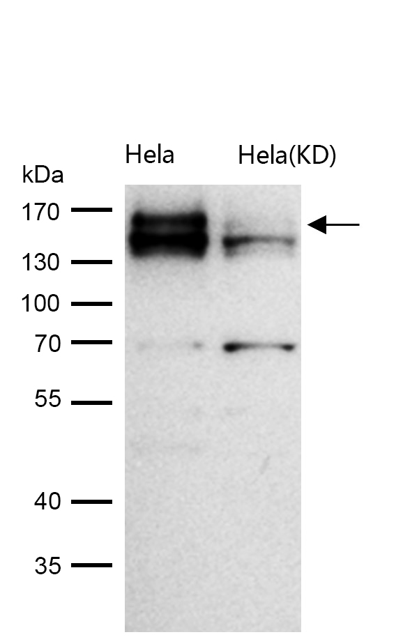 CLSTN1 Rabbit mAb