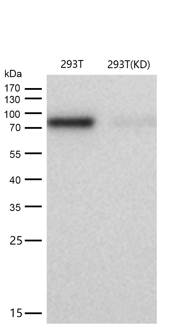 CTP synthase / CTPS Rabbit mAb