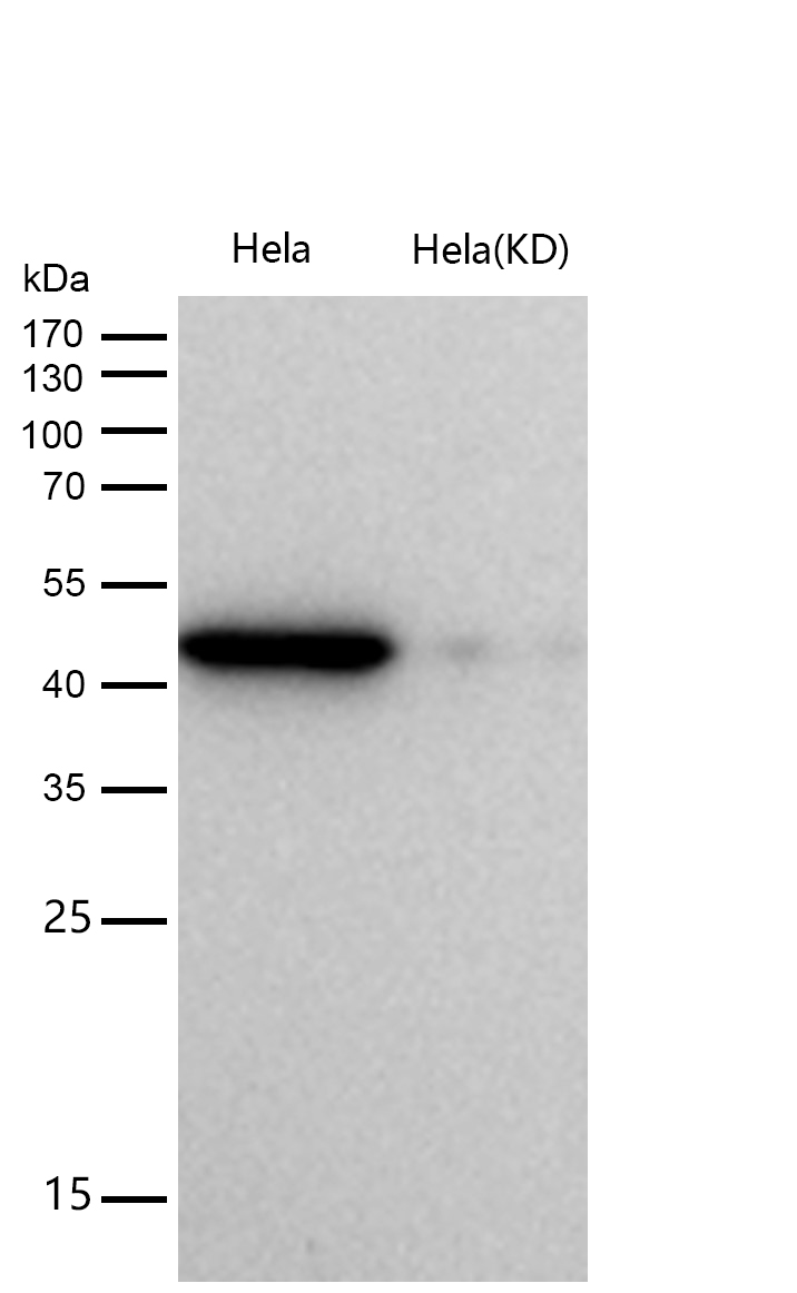 ACAT1 Rabbit mAb