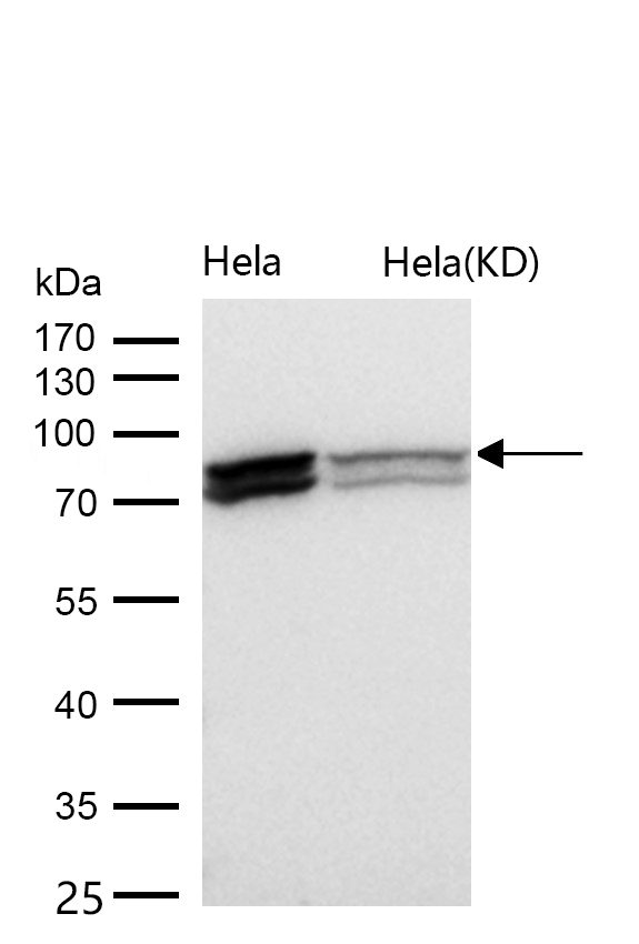 HNRNPM Rabbit mAb