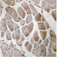 Neuromedin U Antibody