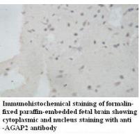 AGAP2 Antibody