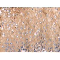 TRIM14 Antibody