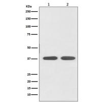 Angiotensin II Type 1 Receptor Rabbit mAb