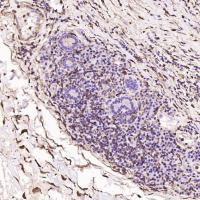 S100A4 Rabbit mAb