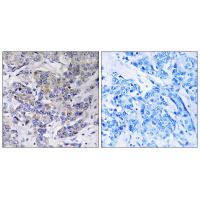 Ribosomal Protein S21 Polyclonal Antibody