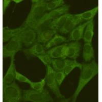 PKM2 mouse mAb