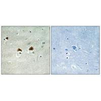 MAP4 (Phospho-Ser696) Antibody