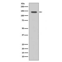 FGFR1 Rabbit mAb