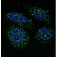 FGFR1 Rabbit mAb