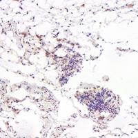 FGFR1 Rabbit mAb