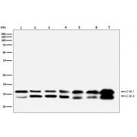 LC3B Rabbit mAb