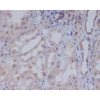ACACB Antibody