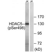 HDAC5(Phospho-Ser498) Antibody