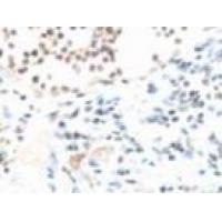 MARVELD1 Antibody