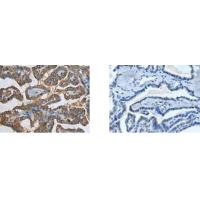 SLC22A12 Antibody