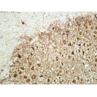 MAP2 Rabbit  mAb