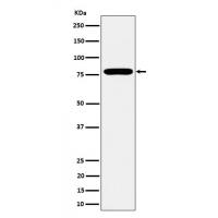 GFPT1 Rabbit mAb