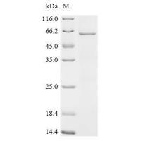 Recombinant Human Histone H1.0(H1F0)