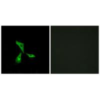 GPR101 Polyclonal Antibody
