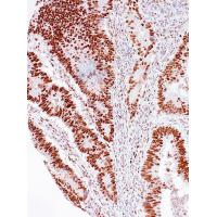 MSH2 Antibody