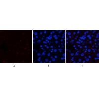 JAK1(Phospho-Tyr1034) Antibody