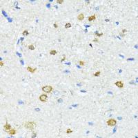 Nestin Polyclonal Antibody
