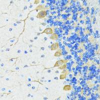 Nestin Polyclonal Antibody