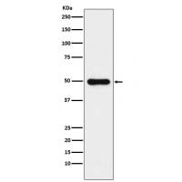 Glutathione Synthetase Rabbit mAb