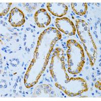 MAP2 Rabbit Polyclonal Antibody