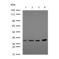 LAT (Phospho-Tyr220) Rabbit mAb