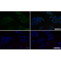 LAT (Phospho-Tyr220) Rabbit mAb