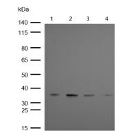 LAT (Phospho-Tyr220) Rabbit mAb