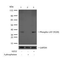 LAT (Phospho-Tyr220) Rabbit mAb