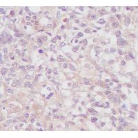 EGFR (Phospho-Y1197) Rabbit mAb