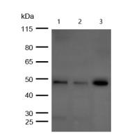 Cyclin E1 (Phospho-Thr77) Rabbit mAb