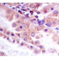GSK3β(Phospho-Ser9) Rabbit mAb