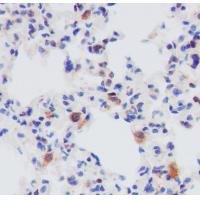 eIF4B (Phospho-Ser406) Rabbit mAb