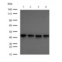 TRAM2 Rabbit mAb