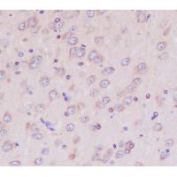 DAP Kinase 1 Rabbit mAb