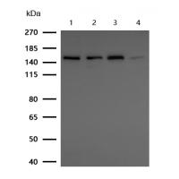 DAP Kinase 1 Rabbit mAb