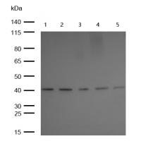 Aspartate Aminotransferase Rabbit mAb 