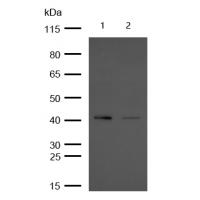 Aspartate Aminotransferase Rabbit mAb 